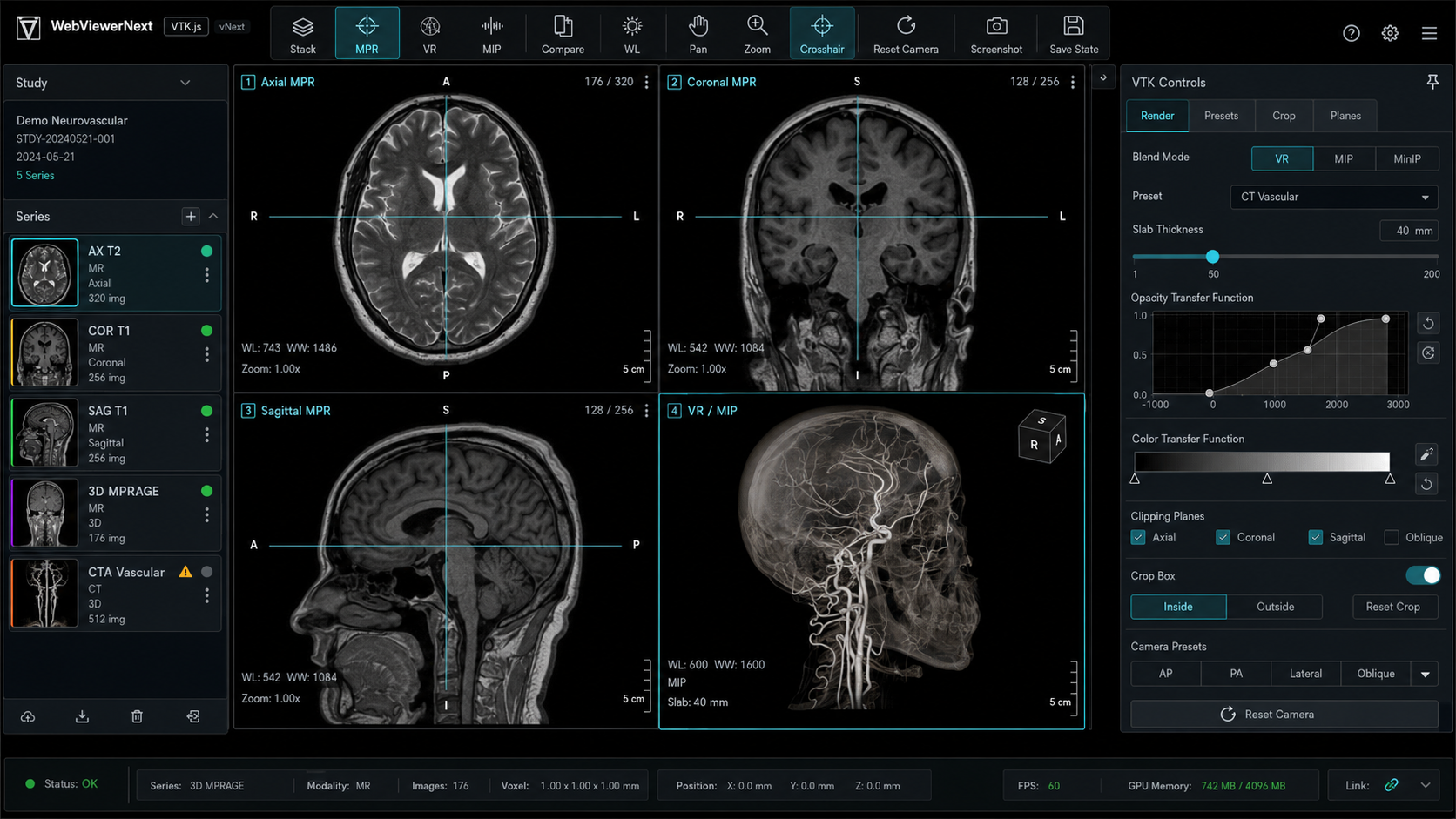 MedView Advanced MR Viewer